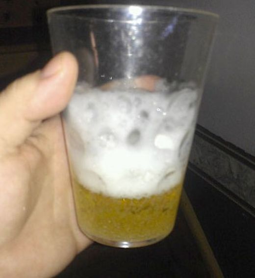 Gebelikte Limon Testi Nedir ve Nasıl Yapılır?