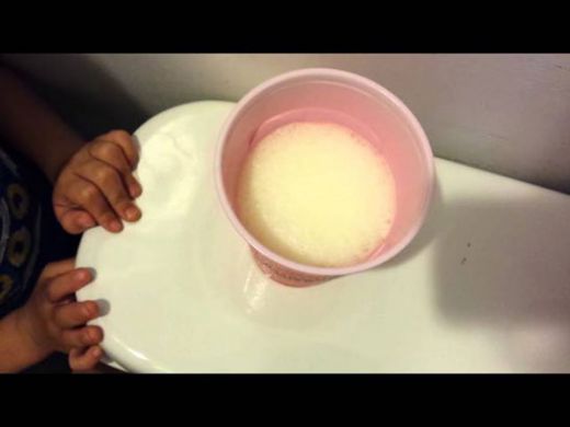 Hamilelikte Limon Testi Nedir ve Nasıl Yapılır?