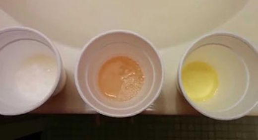 İdrarda Limon ile Gebelik Testi