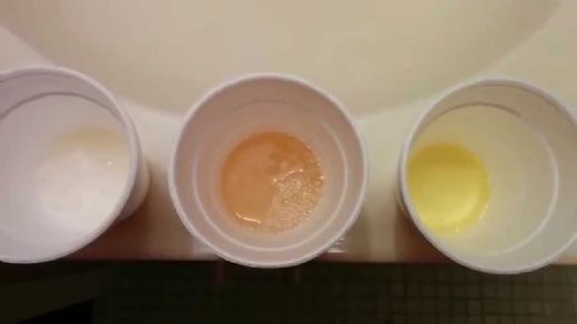 Limon Testi Nedir ve Nasıl Yapılır?