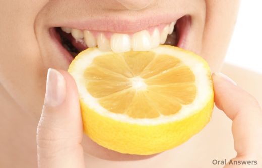 Limonla Diş Beyazlatma Yöntemleri